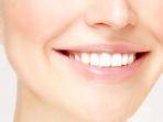 veneer-pada-gigi.jpg