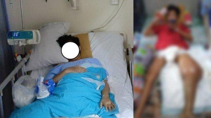Nasib Bocah SD di Bekasi Diduga Jadi Korban Bully Kaki Ditendang Teman, Kini Kaki Harus Diamputasi