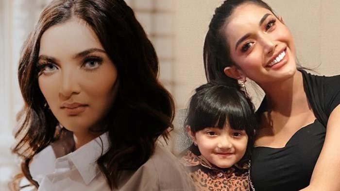 Begini Kondisi Ashanty yang Autoimun Makin Memprihatinkan, Dijenguk Millendaru, Ini Potretnya