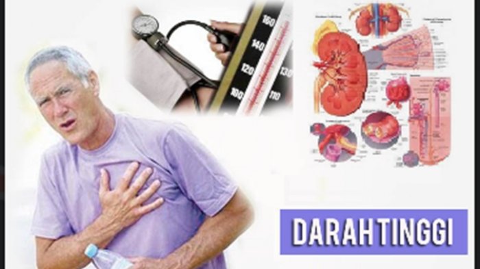 Bisa  Picu Stroke dan Serangan Jantung, Ini 13 Cara Atasi Darah Tinggi Secara Alami