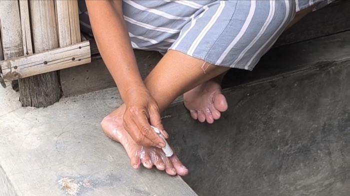 ilustrasi kaki gatal ilustrasi gatal