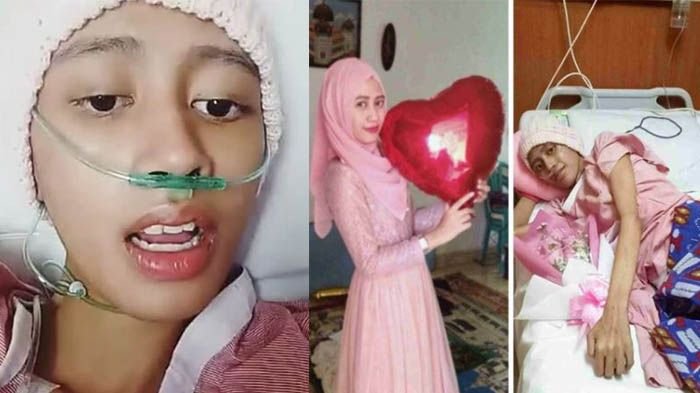 Lolyta Agustina, Penderita Kanker Langka yang Kisahnya Sempat Viral itu Meninggal Dunia