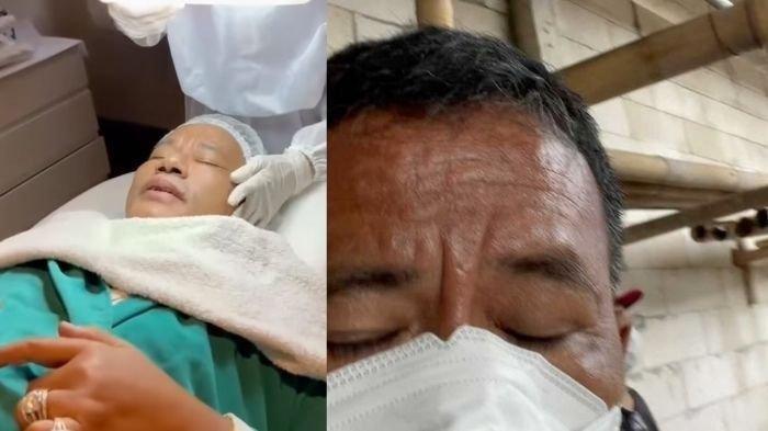 Wajah dan Penampilan Hotman Paris Berubah Disorot, Kini Kurus Mata Sayu, Ternyata ini Penyebabnya