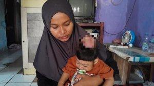 Meli-Melawati-bersama-anaknya-yang-tak-memiliki-tempurung-kepala.jpg