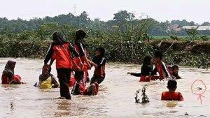 Tangan-korban-murid-SDN-1-Lajer-di-Kecamatan-Tukdana-Kabupaten-Indramayu.jpg