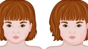 ilustrasi-gondongan.jpg