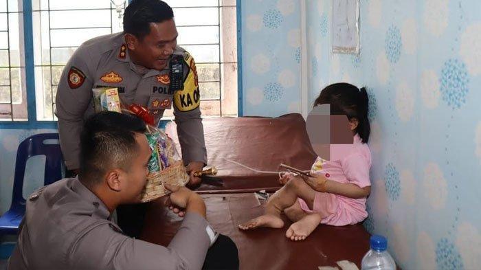 Bocah-perempuan-di-Nias-Selatan-diduga-disiksa-keluarga-selama-bertahun-tahun-hingga-kaki-patah.jpg