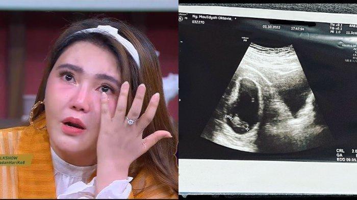 Kabar-duka-Via-Vallen-keguguran-janin-yang-dikandung-tidak-berdetak.jpg