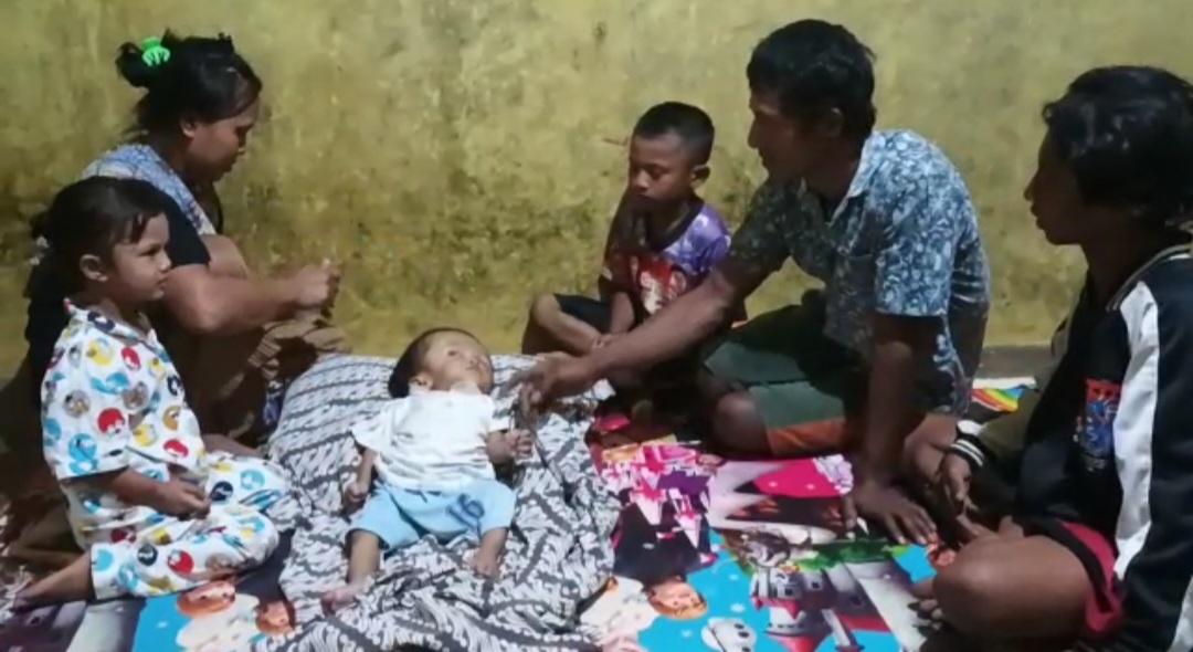 Nasib-pilu-dialami-bayi-berusia-15-bulan-di-Kampung-Karya-Tani-Kabupaten-Sukabumi.jpg