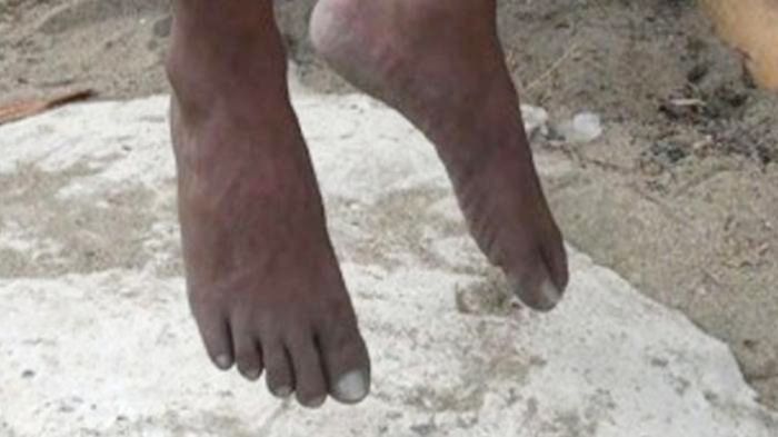 Tak Mampu Bayar Cicilan Motor, Pria Ini Pilih Gantung Diri, Benarkah Gantung Diri Bisa Menular?