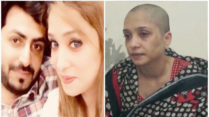 Malangnya Perempuan Ini, Digunduli Suami Karena Menolak Dijual, Lapor Polisi Malah Dimintai Uang