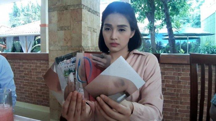 Sedang Makan Siang dengan Ibu, Perempuan Cantik Ini Dianiaya Kakak Sendiri, Dituduh Sebar Informasi