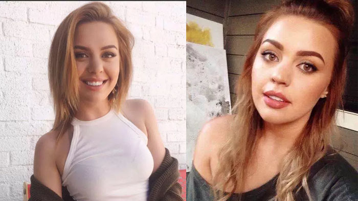 Kebiasaan Pencet Jerawat di Wajah, Gadis Ini Harus Alami Kejadian Nahas. Wanita Wajib Waspada!