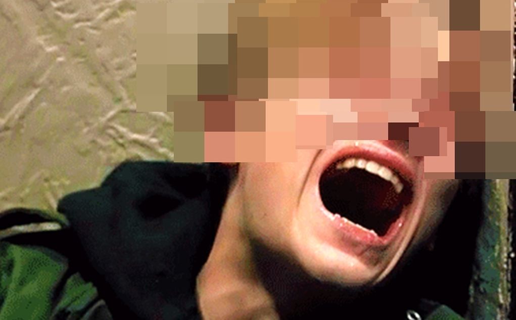 Kasian Banget, Pria Ini Nangis Kesakitan Gara-gara 'Anunya' Patah Ketika Berhubungan