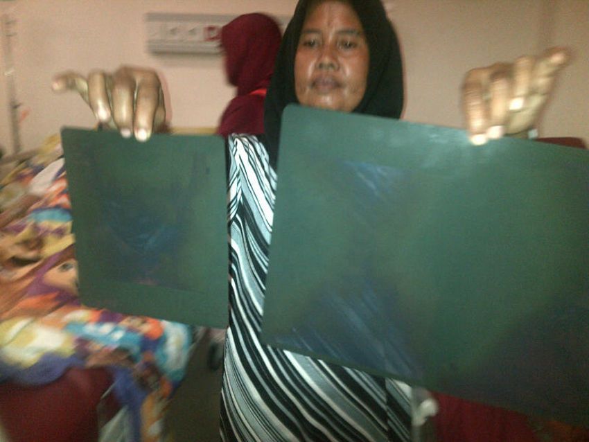 Gadis Tuna Rungu Jadi Korban Pelecehan Seksual Kini Dirawat di RSUD Cibabat