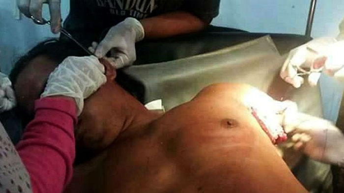 Niat Memancing di Sungai, Pria Ini Justru Bertarung dengan Buaya. Nasibnya Jadi Begini