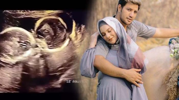 Saat-saat Bayi Kembar Irish Bella Tiada, Ammar Zoni Berlinang Air Mata Sambil Gendong Jenazah