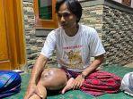 Ahmad-Fauzi-warga-Pagaden-Barat-Subang-menderita-tumor-di-paha-bagian-kanan.jpg