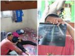 Perkembangan-kasus-siswa-SMK-di-Cikarang-dibully-dan-dikeroyok-kakak-kelas.jpg