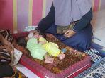 bayi-kembar-siam-di-sukabumi.jpg