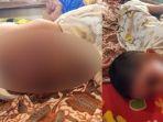 m-rizki-bocah-di-kabupaten-bandung-hanya-bisa-berbaring-setelah-disiksa-orangtuanya.jpg