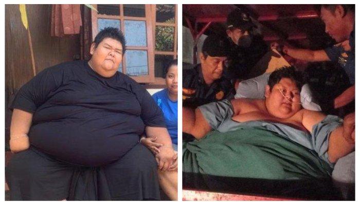 Bombom Pria Obesitas 210 Kg di Bali Meninggal, Teringat Kasus Fajri Berbobot 300 Kg di Tangerang