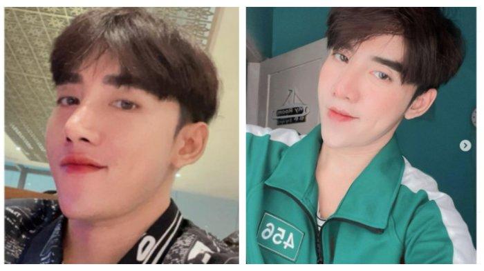Transformasi Wajah Pria Ini Berubah Drastis, Dulu Jadi Sasaran Bully, Kini Glowing Bak Artis Korea