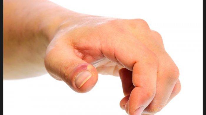 Cara Menyembuhkan Cantengan Tanpa Rasa Sakit, Pakai 6 Obat Tradisional Ala Dapur Ini