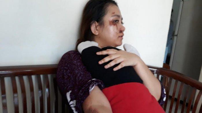 Driver Ojol Bikin Penumpangnya Tersungkur Hingga Wajahnya Garuk Aspal, Lalu Ditinggal Sendirian