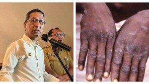 Kolase-Foto-Pj-Gubernur-DKI-Heru-Budi-Hartono-dan-ilustrasi-cacar-monyet.jpg