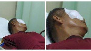 M-Rizki-WahyudiTribunbengkulucom.jpg