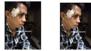 Ridho-korban-penganiayaan-main-hakim-sendiri-di-Cipete-Utara-Jakarta-Selatan-Rabu-2672023.jpg