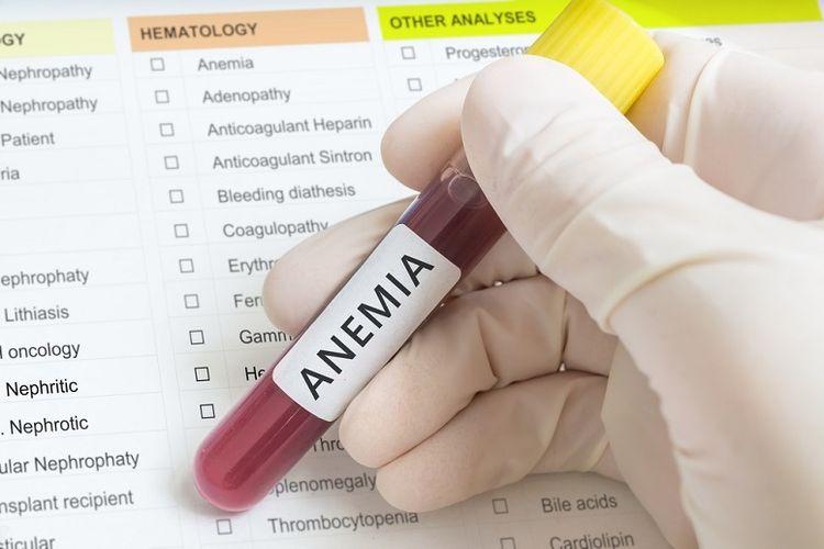 Ilustrasi-anemia-Cara-mudah-untuk-mengetahui-apakah-kamu-kurang-darah-atau-anemia.jpg