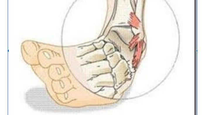 Nyeri Saat Menggerakan Pergelangan Kaki, Bisa Jadi Tanda Cedera Ankle