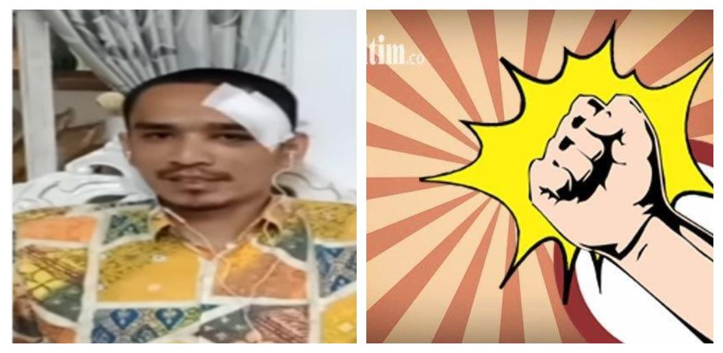 Penata-rias-Fikri-Firdaus-mendapatkan-luka-27-Jahitan-usai-dihantam-gelas-kaca-ole.jpg