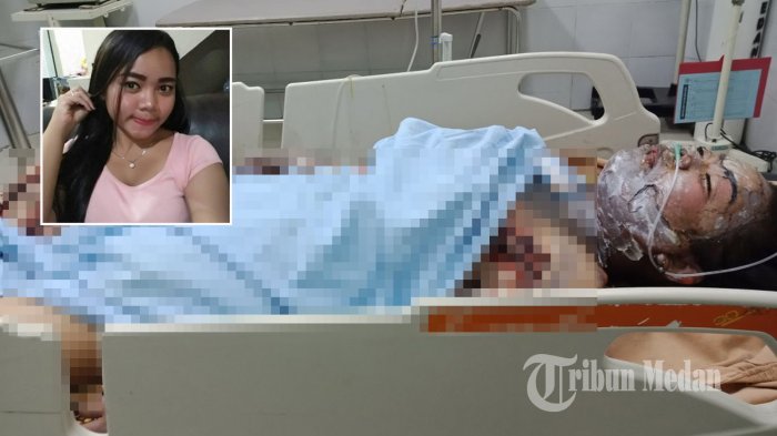 dellisa-ayu-latifa-terbaring-dirawat-di-rsud-pirngadi-medan_20180522_073437.jpg