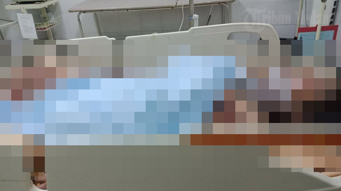 Dipicu Persoalan Asmara, Dellisa Nyaris Tewas Dibakar Pacarnya