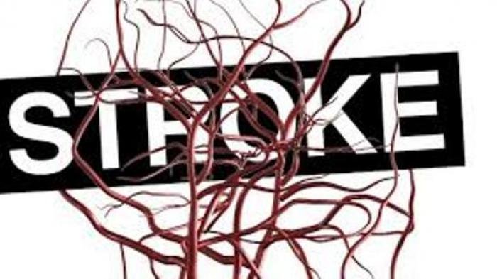 stroke.jpg