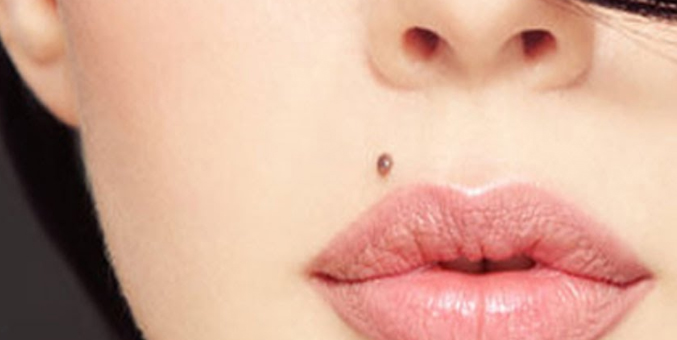 Simak, Tahi Lalat di Bagian Tubuh Ternyata Bisa Ungkap Nasib Seseorang Setelah Menikah