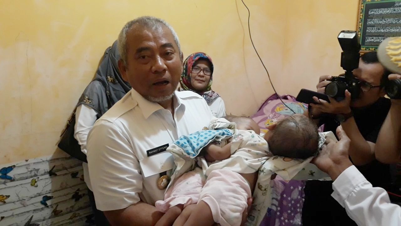 wali-kota-bekasi-rahmat-effendy-menggendong-bayi-kembar-siam.jpg
