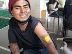 Mantan-anak-punk-Bima-Abdul-Shaleh-saat-menjalani-proses-hapus-tato-2.jpg