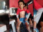 fajar-saefudin-yang-didiagnosis-menderita-tbc-akhirnya-meninggal-dunia.jpg
