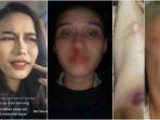 penganiyaan-dialami-mahasiswi-uph-anisa-sakinah-oileh-sang-pacar.jpg