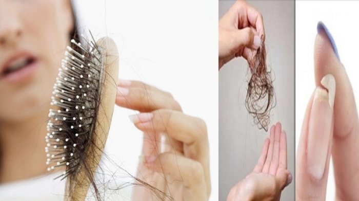 Tak Ingin Rambut Rontok? Hindari 3 Hal ini