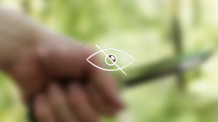 Istri Potong Alat Vital Suami lantaran Cemburu usai Lihat Pesan di Ponsel