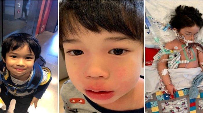 Nyaris Kehilangan Anaknya, Sempat Dikira Demam, Ternyata Setelah Diperiksa Bocah Ini Mengidap Sepsis