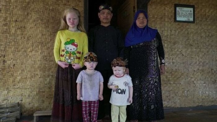 Disebut Kampung 'Bule' Karena Selama 149 Generasi Memiliki Gen Putih