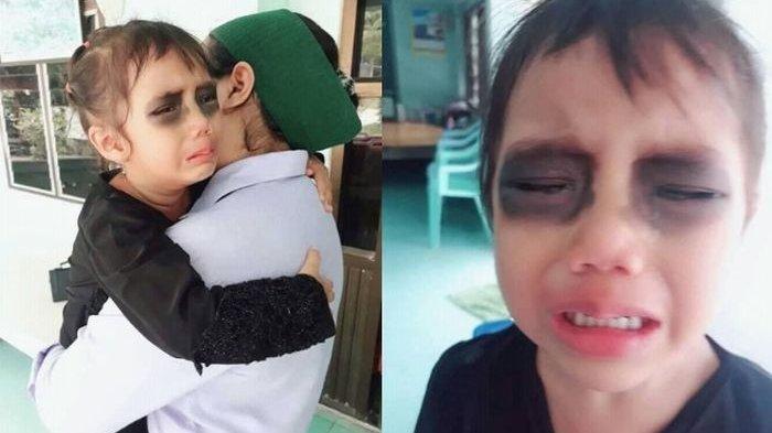 Viral, Kena Usil Ibunya saat Tidur, Bocah Ini Tak Berhenti Menangis Lihat Matanya Menghitam