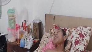 Nasib-Fajar-Tangannya-Harus-Dipotong-Gegara-Tersengat-Listri-Ditolak-Rumah-Sakit-Pakai-BPJS.jpg