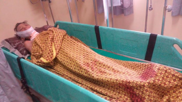 SAD Tewas Tertembak Senjata Rakitan Sendiri